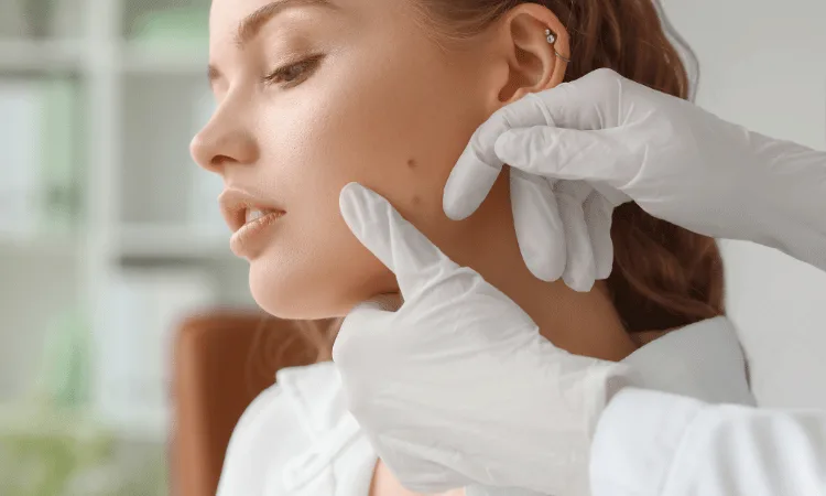 Skin blemish and mole assessment at Izba Spa Wimbledon